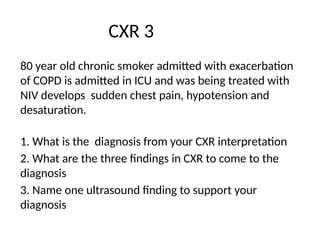 CXR OSCE.pptx in examination point of view | PPTX