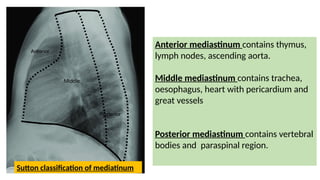 chest xray ppt final for radiology residents | PPTX
