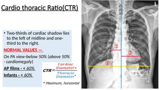 chest xray ppt final for radiology residents | PPTX