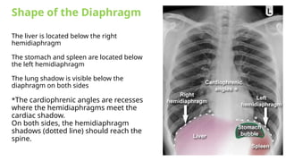CXR Presentation for radiology studies for medical students | PPSX