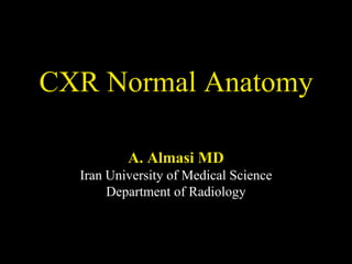 CXR Normal Anatomy
A. Almasi MD
Iran University of Medical Science
Department of Radiology

 