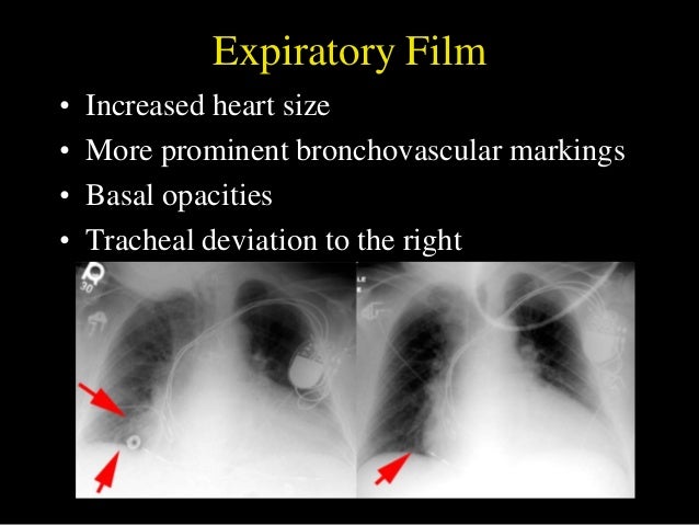 Cxr Revised 24 11 91 cxr-revised-24-11-91
