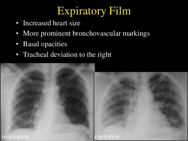 Cxr Revised 24 11 91 cxr-revised-24-11-91