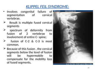 Feil Cervical spine: anatomy, biomechanics and pathomechanics | PDF