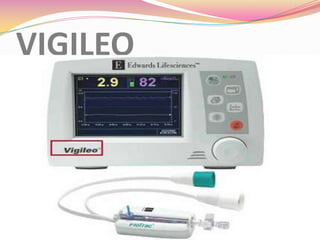 VIGILEO
 