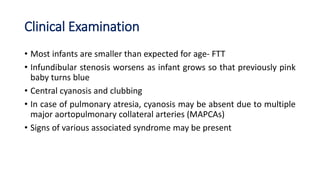 Clinical Examination
• Most infants are smaller than expected for age- FTT
• Infundibular stenosis worsens as infant grows so that previously pink
baby turns blue
• Central cyanosis and clubbing
• In case of pulmonary atresia, cyanosis may be absent due to multiple
major aortopulmonary collateral arteries (MAPCAs)
• Signs of various associated syndrome may be present
 