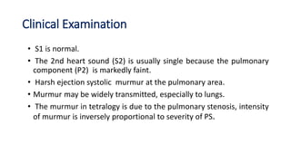 Clinical Examination
• S1 is normal.
• The 2nd heart sound (S2) is usually single because the pulmonary
component (P2) is markedly faint.
• Harsh ejection systolic murmur at the pulmonary area.
• Murmur may be widely transmitted, especially to lungs.
• The murmur in tetralogy is due to the pulmonary stenosis, intensity
of murmur is inversely proportional to severity of PS.
 