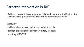 Catheter Intervention in ToF
• Catheter based interventions identify and apply most effective, but
least invasive procedure to most difficult pathologies of ToF
Example –
• balloon dialatation of pulmonary valve stenosis
• balloon dialatation of pulmonary artery stenosis
• stenting of RVOTO
 