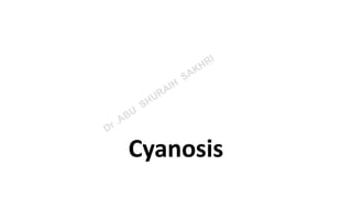 Cyanosis
 