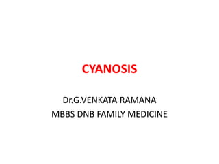 CYANOSIS
Dr.G.VENKATA RAMANA
MBBS DNB FAMILY MEDICINE
 
