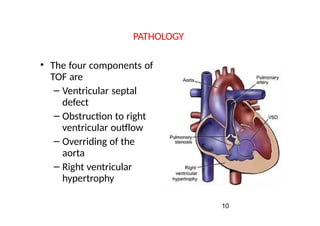 Cyanotic Congenital-Heart-Diseases.pptx