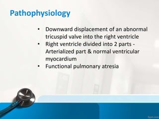 Pathophysiology
• Downward displacement of an abnormal
tricuspid valve into the right ventricle
• Right ventricle divided into 2 parts -
Arterialized part & normal ventricular
myocardium
• Functional pulmonary atresia
 