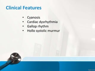 Clinical Features
• Cyanosis
• Cardiac dysrhythmia
• Gallop rhythm
• Hollo systolic murmur
 