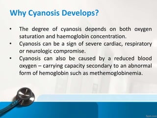 Why Cyanosis Develops?
• The degree of cyanosis depends on both oxygen
saturation and haemoglobin concentration.
• Cyanosis can be a sign of severe cardiac, respiratory
or neurologic compromise.
• Cyanosis can also be caused by a reduced blood
oxygen – carrying capacity secondary to an abnormal
form of hemoglobin such as methemoglobinemia.
 