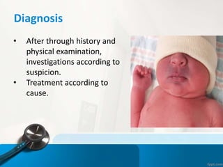 Diagnosis
• After through history and
physical examination,
investigations according to
suspicion.
• Treatment according to
cause.
 