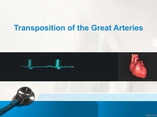 Transposition of the Great Arteries
 