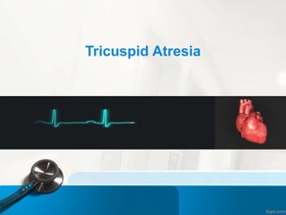 Tricuspid Atresia
 
