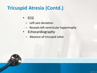 Tricuspid Atresia (Contd.)
• ECG
– Left axis deviation
– Reveals left ventricular hypertrophy
• Echocardiography
– Absence of tricuspid valve
 