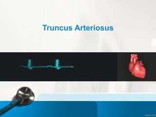 Truncus Arteriosus
 