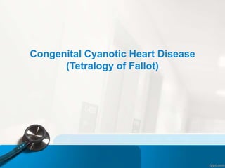 Congenital Cyanotic Heart Disease
(Tetralogy of Fallot)
 