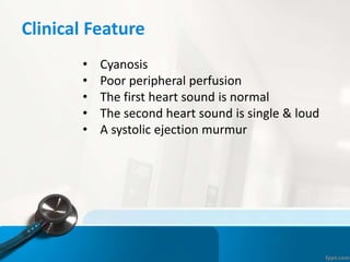 Clinical Feature
• Cyanosis
• Poor peripheral perfusion
• The first heart sound is normal
• The second heart sound is single & loud
• A systolic ejection murmur
 