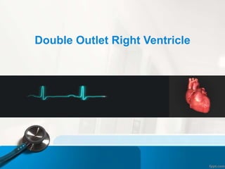 Double Outlet Right Ventricle
 