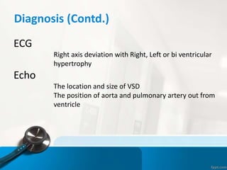 Diagnosis (Contd.)
ECG
Right axis deviation with Right, Left or bi ventricular
hypertrophy
Echo
The location and size of VSD
The position of aorta and pulmonary artery out from
ventricle
 