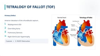Advanced Medical Education on Cyanotic Congenital Heart Disease ...