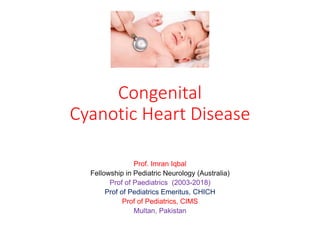 Congenital
Cyanotic Heart Disease
Prof. Imran Iqbal
Fellowship in Pediatric Neurology (Australia)
Prof of Paediatrics (2003-2018)
Prof of Pediatrics Emeritus, CHICH
Prof of Pediatrics, CIMS
Multan, Pakistan
 