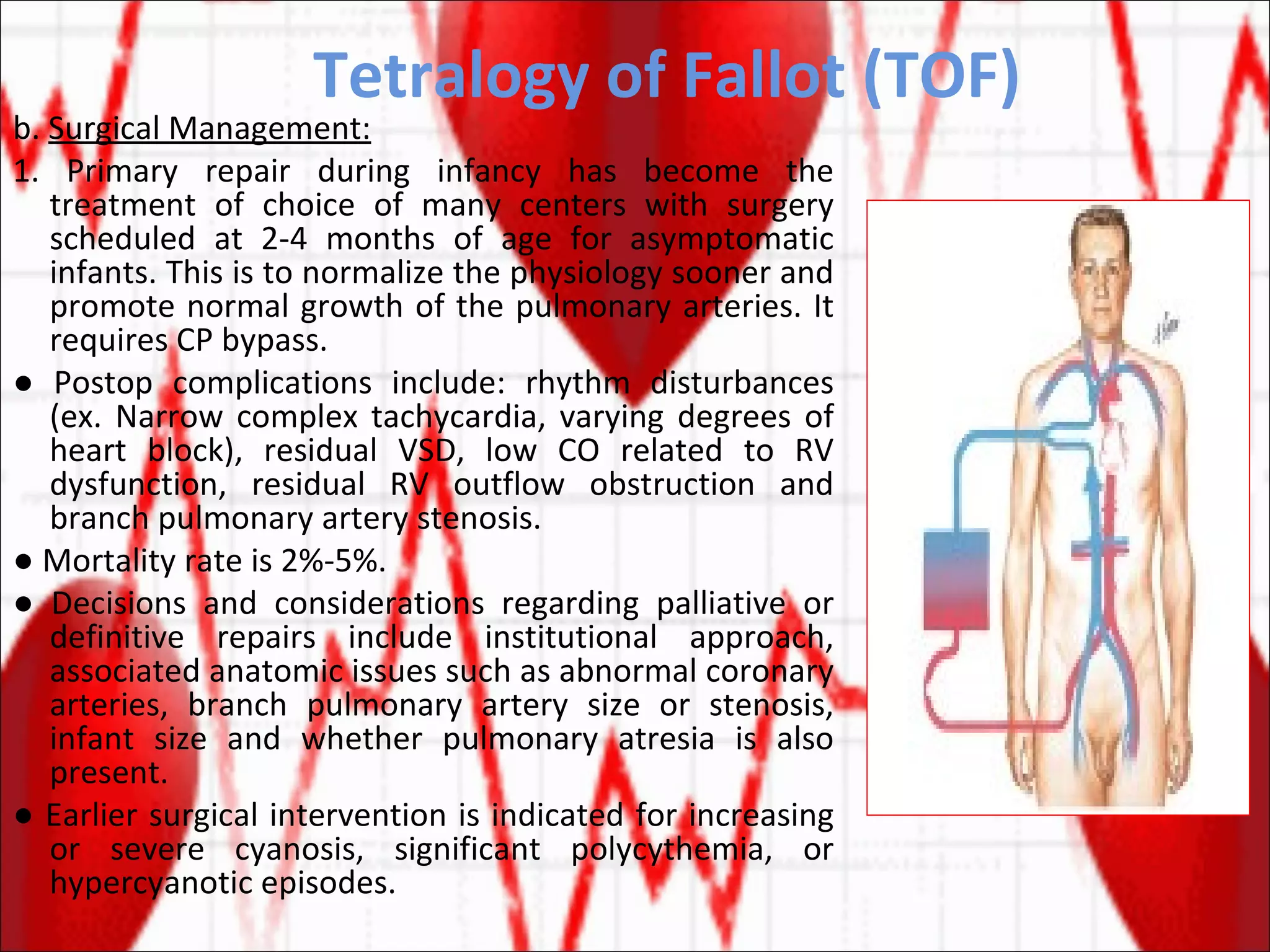 Tetralogy of Fallot (TOF) b.  Surgical Management: 1. Primary repair during infancy has become the treatment of choice of many centers with surgery scheduled at 2-4 months of age for asymptomatic infants. This is to normalize the physiology sooner and promote normal growth of the pulmonary arteries. It requires CP bypass. ●  Postop complications include: rhythm disturbances (ex. Narrow complex tachycardia, varying degrees of heart block), residual VSD, low CO related to RV dysfunction, residual RV outflow obstruction and branch pulmonary artery stenosis. ●  Mortality rate is 2%-5%. ●  Decisions and considerations regarding palliative or definitive repairs include institutional approach, associated anatomic issues such as abnormal coronary arteries, branch pulmonary artery size or stenosis, infant size and whether pulmonary atresia is also present. ●  Earlier surgical intervention is indicated for increasing or severe cyanosis, significant polycythemia, or hypercyanotic episodes.  