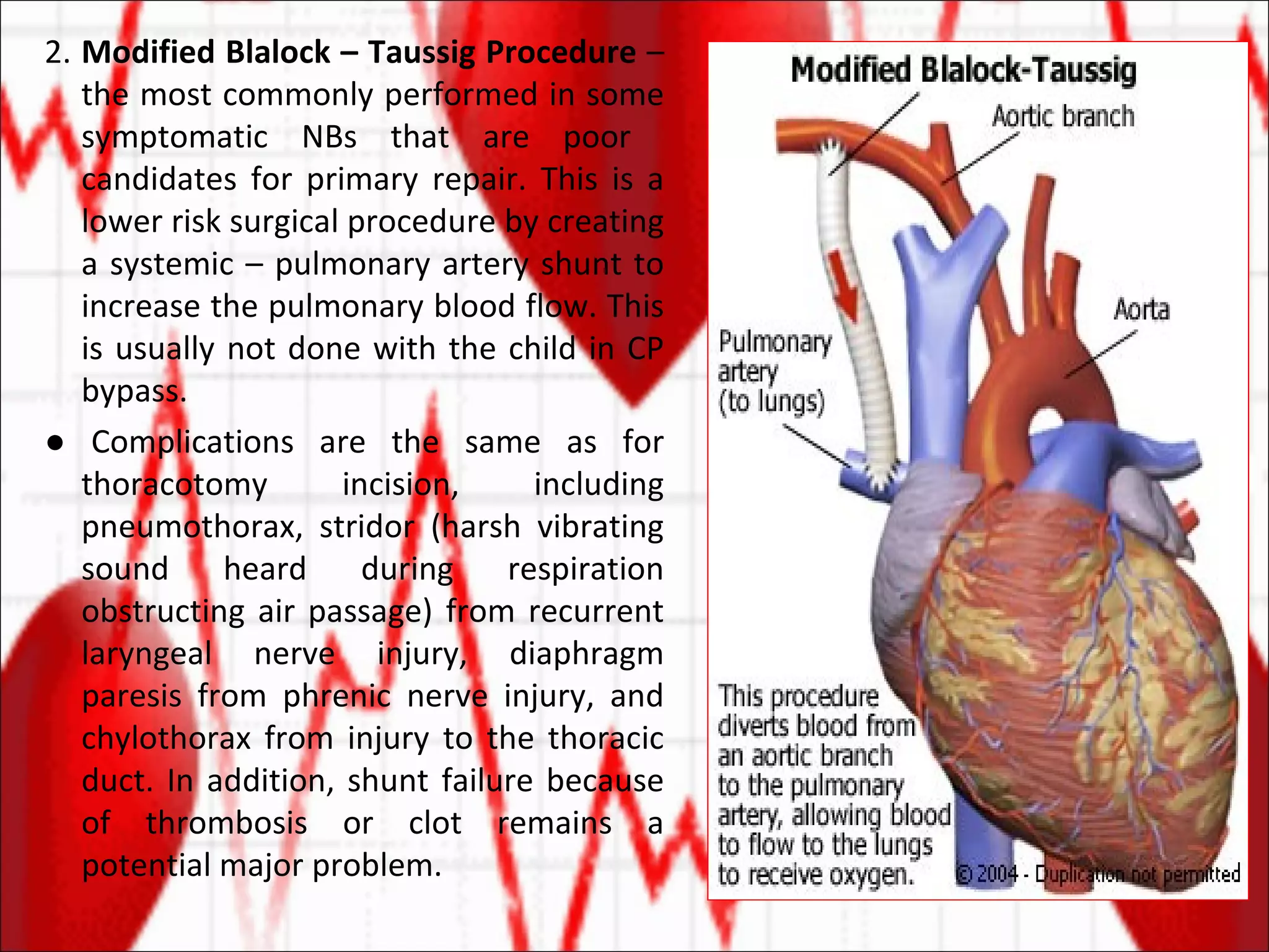 2.  Modified Blalock – Taussig Procedure  – the most commonly performed in some symptomatic NBs that are poor  candidates for primary repair. This is a lower risk surgical procedure by creating a systemic – pulmonary artery shunt to increase the pulmonary blood flow. This is usually not done with the child in CP bypass.  ●  Complications are the same as for thoracotomy incision, including pneumothorax, stridor (harsh vibrating sound heard during respiration obstructing air passage) from recurrent laryngeal nerve injury, diaphragm paresis from phrenic nerve injury, and chylothorax from injury to the thoracic duct. In addition, shunt failure because of thrombosis or clot remains a potential major problem. 