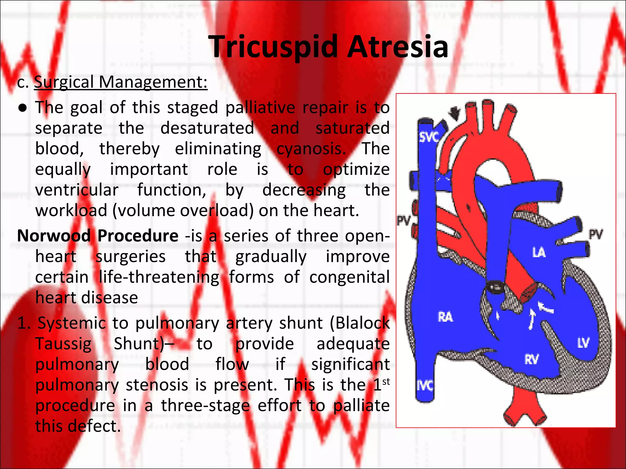 Tricuspid Atresia c.  Surgical Management: ●  The goal of this staged palliative repair is to separate the desaturated and saturated blood, thereby eliminating cyanosis. The equally important role is to optimize ventricular function, by decreasing the workload (volume overload) on the heart. Norwood Procedure  -is a series of three open-heart surgeries that gradually improve certain life-threatening forms of congenital heart disease 1. Systemic to pulmonary artery shunt (Blalock Taussig Shunt)– to provide adequate pulmonary blood flow if significant pulmonary stenosis is present. This is the 1 st  procedure in a three-stage effort to palliate this defect. 