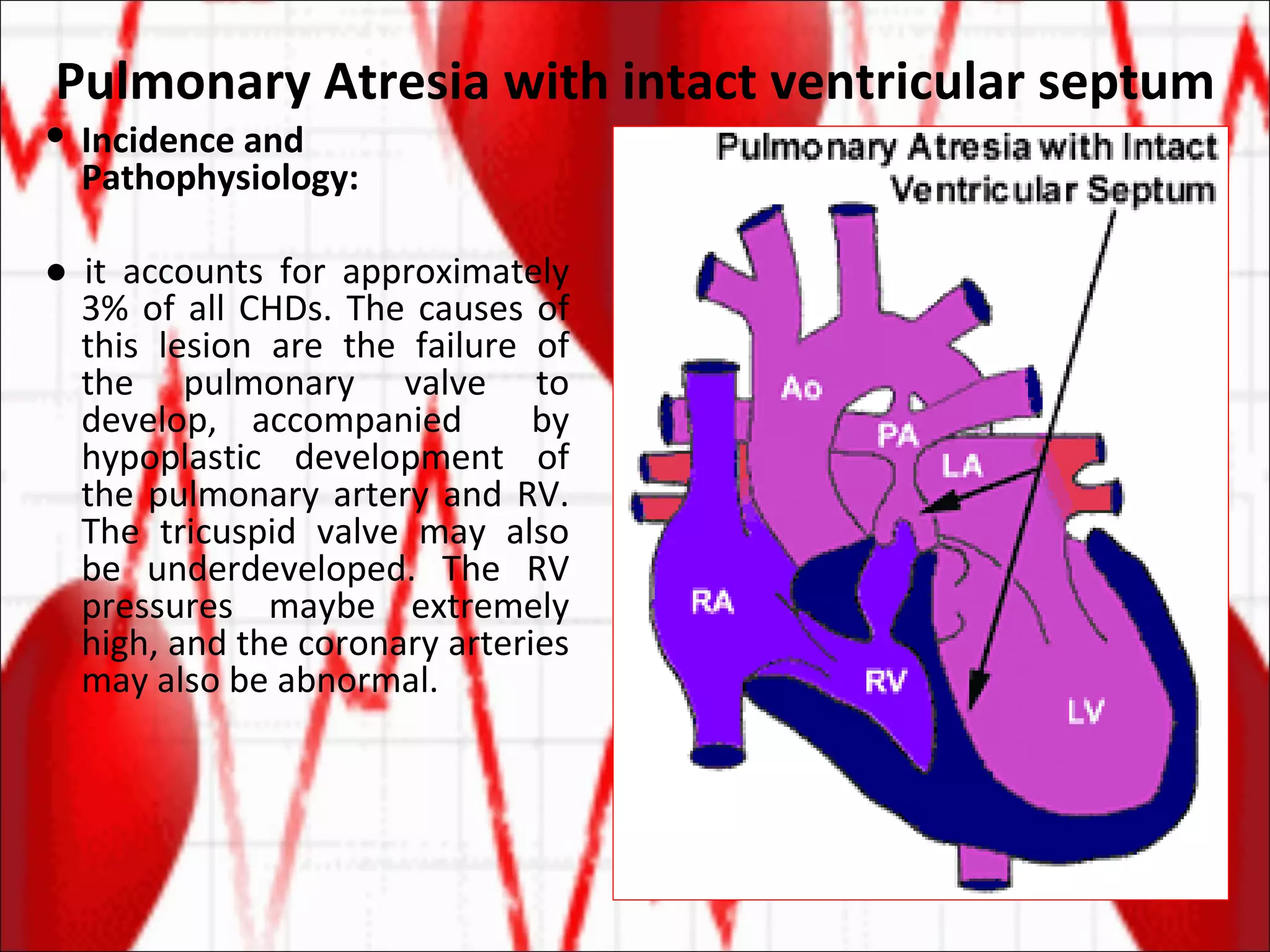 Pulmonary Atresia with intact ventricular septum Incidence and Pathophysiology: ●  it accounts for approximately 3% of all CHDs. The causes of this lesion are the failure of the pulmonary valve to develop, accompanied  by hypoplastic development of the pulmonary artery and RV. The tricuspid valve may also be underdeveloped. The RV pressures maybe extremely high, and the coronary arteries may also be abnormal. 