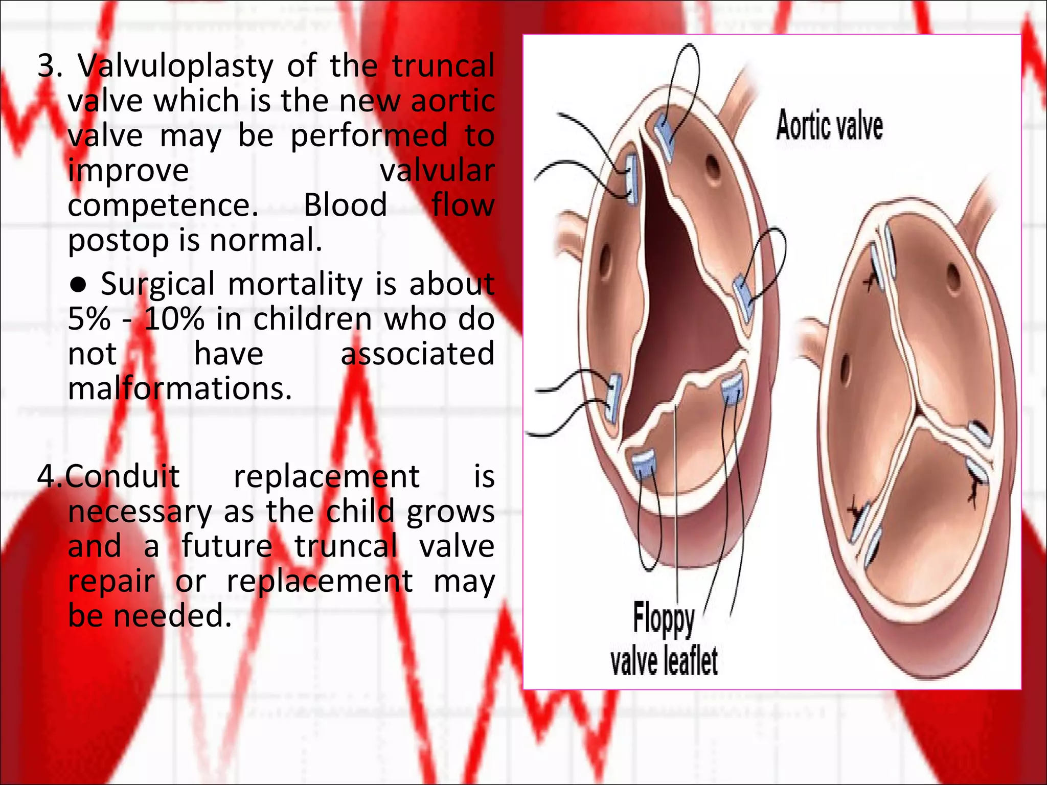 3. Valvuloplasty of the truncal valve which is the new aortic valve may be performed to improve valvular competence. Blood flow postop is normal. ●  Surgical mortality is about 5% - 10% in children who do not have associated malformations. 4.Conduit replacement is necessary as the child grows and a future truncal valve repair or replacement may be needed.  