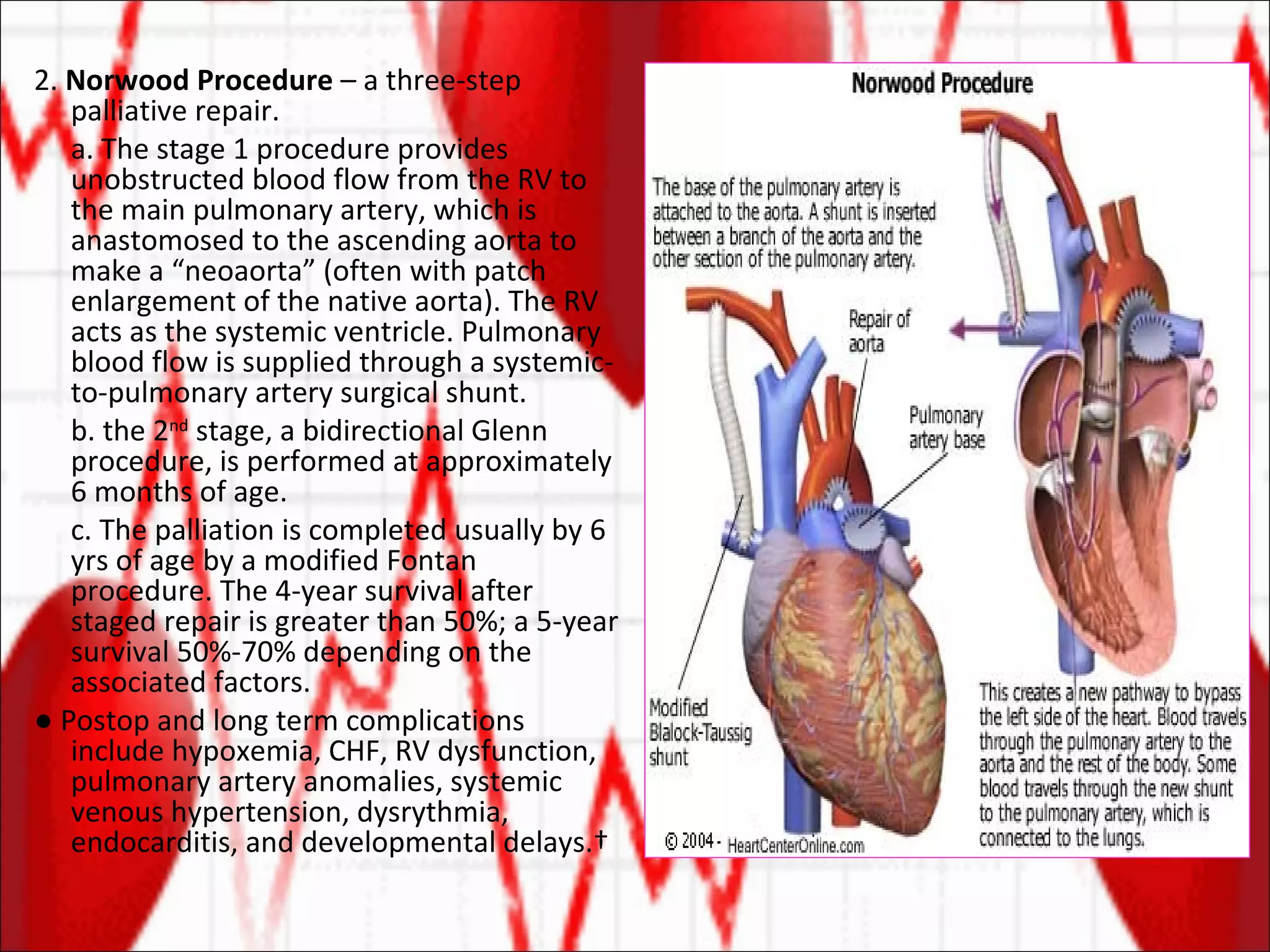 2.  Norwood Procedure  – a three-step palliative repair. a. The stage 1 procedure provides unobstructed blood flow from the RV to the main pulmonary artery, which is anastomosed to the ascending aorta to make a “neoaorta” (often with patch enlargement of the native aorta). The RV acts as the systemic ventricle. Pulmonary blood flow is supplied through a systemic-to-pulmonary artery surgical shunt. b. the 2 nd  stage, a bidirectional Glenn procedure, is performed at approximately 6 months of age.  c. The palliation is completed usually by 6 yrs of age by a modified Fontan procedure. The 4-year survival after staged repair is greater than 50%; a 5-year survival 50%-70% depending on the associated factors. ●  Postop and long term complications include hypoxemia, CHF, RV dysfunction, pulmonary artery anomalies, systemic venous hypertension, dysrythmia, endocarditis, and developmental delays.  