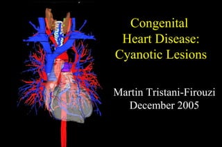 Congenital  Heart Disease: Cyanotic Lesions Martin Tristani-Firouzi December 2005 
