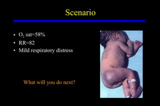 Scenario O 2  sat=58% RR=82 Mild respiratory distress What will you do next? 