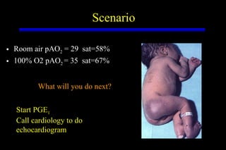 Scenario Room air pAO 2  = 29  sat=58% 100% O2 pAO 2  = 35  sat=67% What will you do next? Start PGE 1 Call cardiology to do echocardiogram 