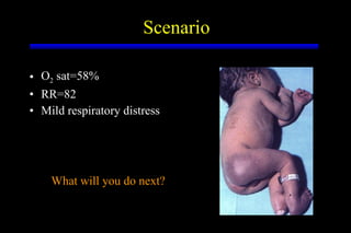 Scenario <ul><li>O 2  sat=58% </li></ul><ul><li>RR=82 </li></ul><ul><li>Mild respiratory distress </li></ul>What will you ...