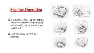 Senning Operation
 It uses atrial septal flap and the RA
free wall to redirect the pulmonary
and systemic venous returns at the
atrial level.
 First performed in 1958 by
Senning.
 