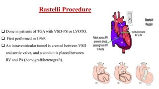 Rastelli Procedure
 Done in patients of TGA with VSD-PS or LVOTO.
 First performed in 1969.
 An intraventricular tunnel is created between VSD
and aortic valve, and a conduit is placed between
RV and PA (homograft/heterograft).
 