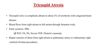 Tricuspid Atresia
• Tricuspid valve is completely absent in about 2% of newborns with congenital heart
disease.
• Blood flows from right atrium to left atrium through foramen ovale.
• Early cyanosis. DDs
 TGV, TA, PA, Severe TOF, Ebstein’s anomaly.
• Repair consists of shunt from right atrium to pulmonary artery or rudimentary right
ventricle (Fontan procedure).
 