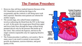 • However, they still have marked hypoxia (because of the
IVC blood that is not fed into the lungs to be
oxygenated), and the ventricle is still doing more work
than expected. Therefore most patients are referred for
another surgery.
• The second stage, also called Fontan completion,
involves redirecting the blood from the IVC to the lungs
as well. At this point, the oxygen-poor blood from upper
and lower body flows through the lungs without being
pumped (driven only by the pressure that builds up in
the veins). This corrects the hypoxia, and leaves the
single ventricle responsible only for supplying blood to
the body.
• The Fontan procedure is palliative, not curative. But in
many cases it can result in normal or near-normal
growth, development, exercise tolerance, and good
quality of life.
The Fontan Procedure
In many cases, patients will eventually require heart transplantation
 