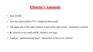 Ebstein’s Anomaly
• Rare CCHD
• Post and septal leaflet of TV –displaced downwards
• The upper part of the right ventricle is part of the right atrium – atralized rt ventricle
• Rt ventricle is too small and Rt. Atrium is too large
• Leaflets – malformed and fused – obstruction of flow to rt ventricle
 