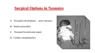 Surgical Options in Neonates
A. Tricuspid valvuloplasty —poor outcome
B. Starnes procedure
C. Neonatal biventricular repair
D. Cardiac transplantation
 
