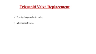 Tricuspid Valve Replacement
• Porcine bioprosthetic valve
• Mechanical valve
 