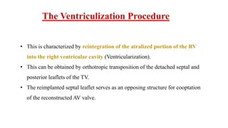 The Ventriculization Procedure
• This is characterized by reintegration of the atralized portion of the RV
into the right ventricular cavity (Ventricularization).
• This can be obtained by orthotropic transposition of the detached septal and
posterior leaflets of the TV.
• The reimplanted septal leaflet serves as an opposing structure for cooptation
of the reconstructed AV valve.
 