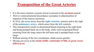 Transposition of the Great Arteries
• It is the most common cyanotic lesion to present in the newborn period.
• TGA is ventriculoarterial discordance secondary to abnormalities of
septation of the truncus arteriosus.
• In TGA, the aorta arises from the right ventricle, anterior and to the right
of the pulmonary artery, which arises from the left ventricle.
• This transposition results in desaturated blood returning to the right heart
and being pumped back out to the body, while well-oxygenated blood
returning from the lungs enters the left heart and is pumped back to the
lungs.
• Without mixing of the two circulations, death occurs quickly.
• Mixing can occur at the atrial (ASD), ventricular (VSD), or great vessel
(PDA) level.
 