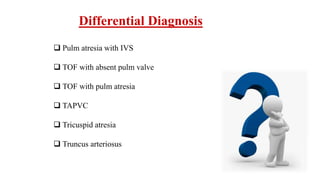 Differential Diagnosis
 Pulm atresia with IVS
 TOF with absent pulm valve
 TOF with pulm atresia
 TAPVC
 Tricuspid atresia
 Truncus arteriosus
 