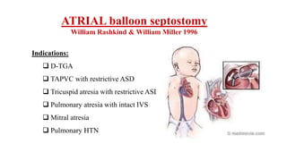 ATRIAL balloon septostomy
William Rashkind & William Miller 1996
Indications:
 D-TGA
 TAPVC with restrictive ASD
 Tricuspid atresia with restrictive ASD
 Pulmonary atresia with intact IVS
 Mitral atresia
 Pulmonary HTN
 
